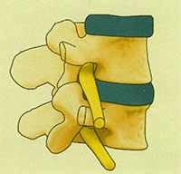 Normal Spine